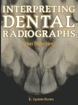 portada Interpreting Dental Radiographs (en Inglés)