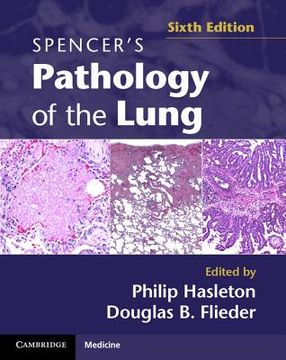 portada spencer`s pathology of the lung (in English)