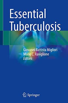 portada Essential Tuberculosis (en Inglés)