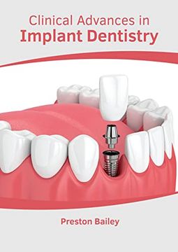 portada Clinical Advances in Implant Dentistry (en Inglés)
