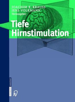 portada Tiefe Hirnstimulation (en Alemán)