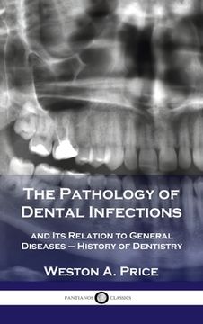 portada Pathology of Dental Infections: and Its Relation to General Diseases - History of Dentistry (en Inglés)