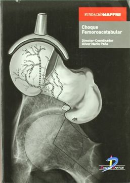 portada Choque Femoroacetabular (in Spanish)