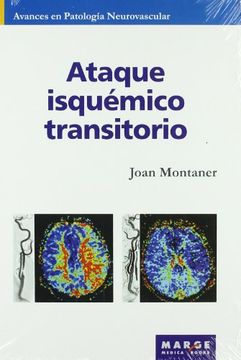 ataque isquémico transitorio
