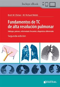 portada Fundamentos de TC de Alta Resolución Pulmonar. Hallazgos, patrones, enfermedades frecuentes y diagnósticos diferenciales (in Spanish)