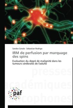portada IRM de perfusion par marquage des spins: Evaluation du degré de malignité dans les tumeurs cérébrales de l'adulte