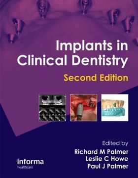 portada Implants in Clinical Dentistry (in English)