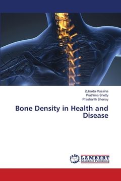 portada Bone Density in Health and Disease (en Inglés)
