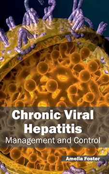 portada Chronic Viral Hepatitis: Management and Control 