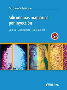 portada Siliconomas Mamarios por Inyeccion. Clinica, Diagnostico, Tratamiento (in Spanish)