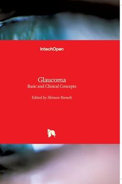 portada Glaucoma: Basic and Clinical Concepts (in English)