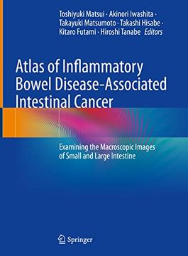 portada Atlas of Inflammatory Bowel Disease-Associated Intestinal Cancer: Examining the Macroscopic Images of Small and Large Intestine (en Inglés)
