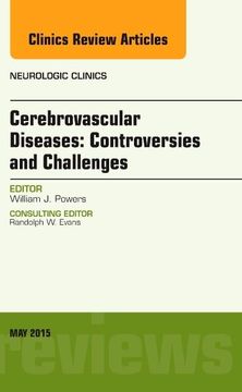 portada Cerebrovascular Diseases: Controversies and Challenges, an Issue of Neurologic Clinics (Volume 33-2) (The Clinics: Radiology, Volume 33-2) (en Inglés)