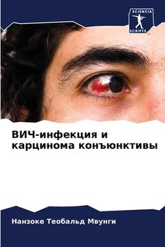 portada ВИЧ-инфекция и карцинома (en Ruso)