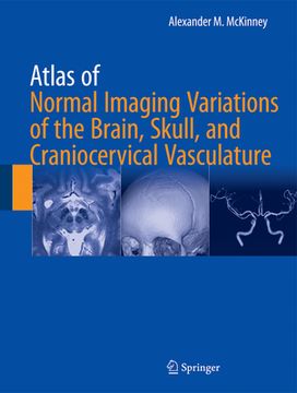 portada Atlas of Normal Imaging Variations of the Brain, Skull, and Craniocervical Vasculature (en Inglés)
