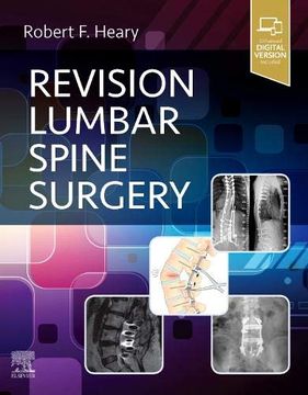 portada Revision Lumbar Spine Surgery (in English)