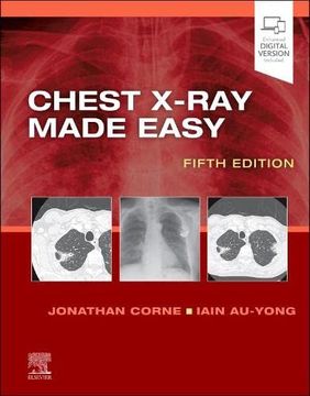 portada Chest X-Ray Made Easy (in English)