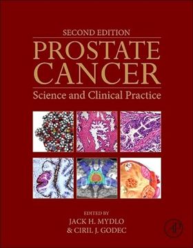 portada Prostate Cancer: Science and Clinical Practice