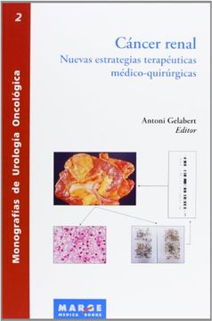 portada Cáncer renal: Nuevas estrategias terapéuticas médico-quirúrgicas (in Spanish)