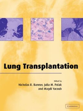 portada Lung Transplantation (en Inglés)
