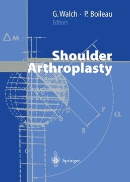 portada Shoulder Arthroplasty