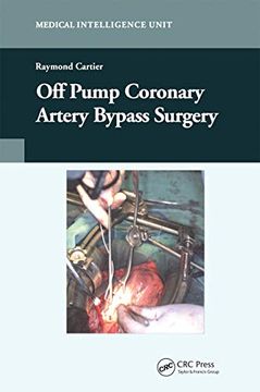 portada Off-Pump Coronary Artery Bypass Surgery 