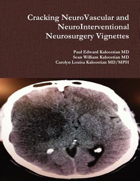 portada cracking neurovascular and neurointerventional neurosurgery vignettes (en Inglés)