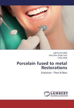 portada Porcelain fused to metal Restorations