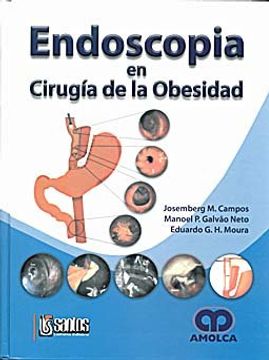 Libro Endoscopia en Cirugia de la Obesidad De Josemberg Campos
