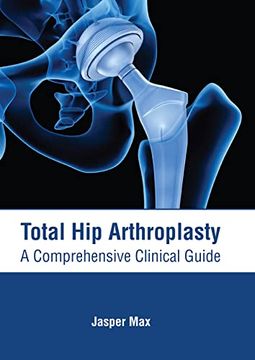 portada Total hip Arthroplasty: A Comprehensive Clinical Guide (in English)