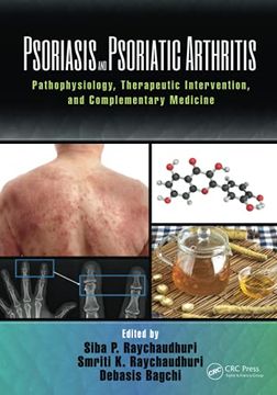 portada Psoriasis and Psoriatic Arthritis: Pathophysiology, Therapeutic Intervention, and Complementary Medicine (en Inglés)