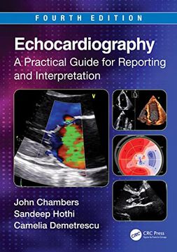 portada Echocardiography (en Inglés)
