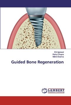 portada Guided Bone Regeneration (en Inglés)