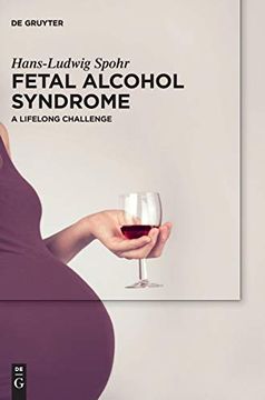 portada Fetal Alcohol Syndrome (en Inglés)