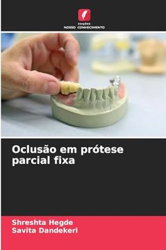 portada Oclusão em Prótese Parcial Fixa (en Portugués)