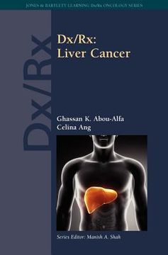 portada dx/rx: liver cancer