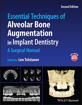 portada Essential Techniques of Alveolar Bone Augmentation in Implant Dentistry: A Surgical Manual (en Inglés)