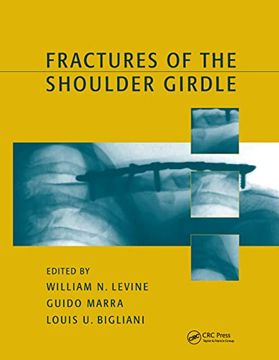 portada Fractures of the Shoulder Girdle (in English)