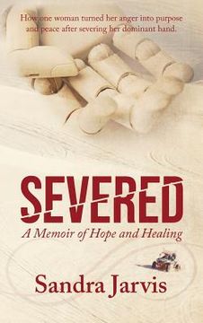 portada Severed: A Memoir of Hope and Healing (en Inglés)