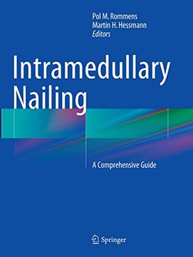portada Intramedullary Nailing: A Comprehensive Guide (in English)