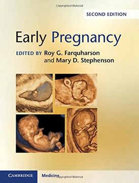 portada Early Pregnancy
