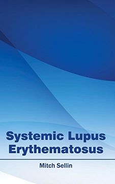 portada Systemic Lupus Erythematosus (en Inglés)