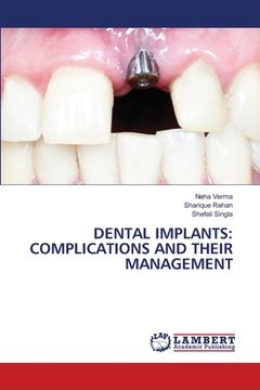 portada Dental Implants: Complications and Their Management (en Inglés)