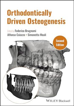 portada Orthodontically Driven Osteogenesis (en Inglés)