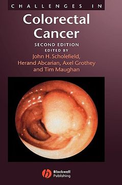 portada challenges in colorectal cancer, 2nd edition