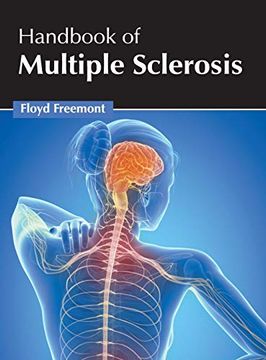 portada Handbook of Multiple Sclerosis 
