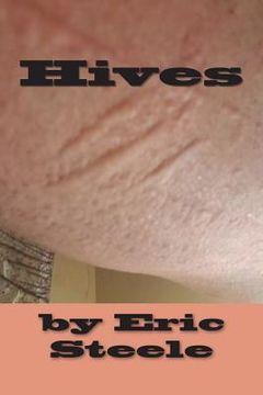 portada Hives (en Inglés)