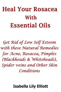 portada Heal Your Rosacea With Essential Oils: Get rid of low Self Esteem With These Natural Remedies for Acne, Rosacea, Pimples (Blackheads & Whiteheads), Spider Veins and Other Skin Conditions (en Inglés)