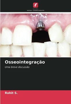 portada Osseointegração: Uma Breve Discussão (en Portugués)