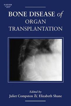 portada Bone Disease of Organ Transplantation (en Inglés)